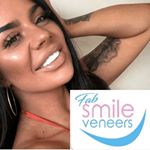 Fab Smile Veneers logo